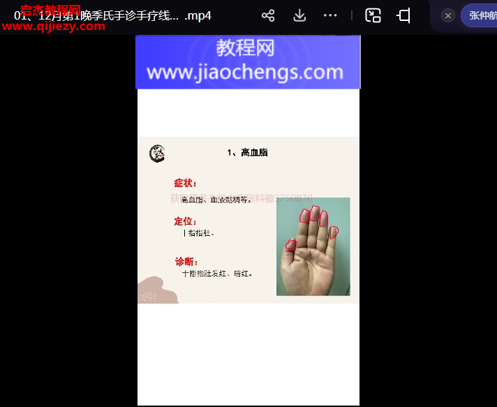 張仲行季氏手診手療線上直播視頻課程2集百度網(wǎng)盤下載學(xué)習(xí)