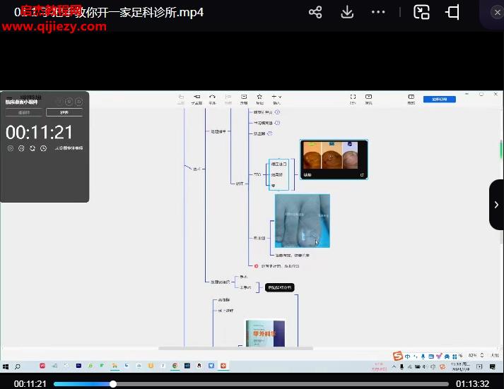 劉醫(yī)生足科診所第二屆足病疼痛培訓(xùn)班視頻課程12集百度網(wǎng)盤下載學(xué)習(xí)